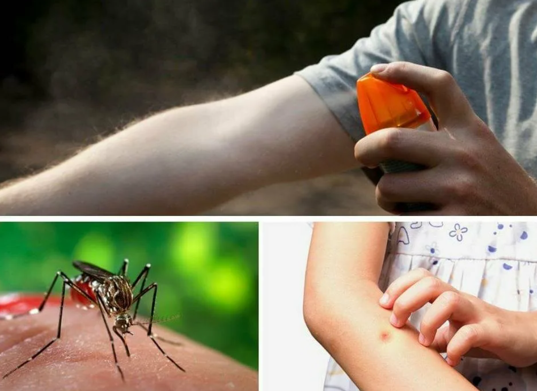 Как защитить ребенка от насекомых? Лучшие средства